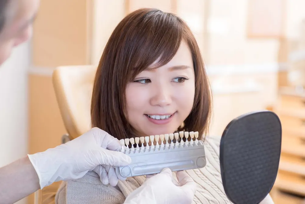 Smile Makeover Oceanside