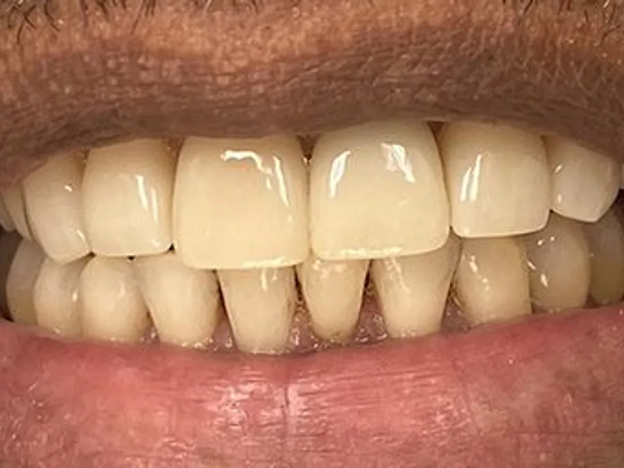 Complete Cosmetic Makeover, after