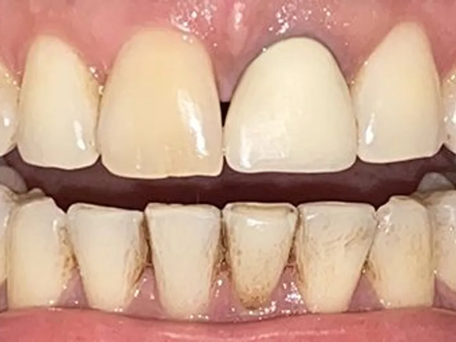 Complete Cosmetic Makeover, before