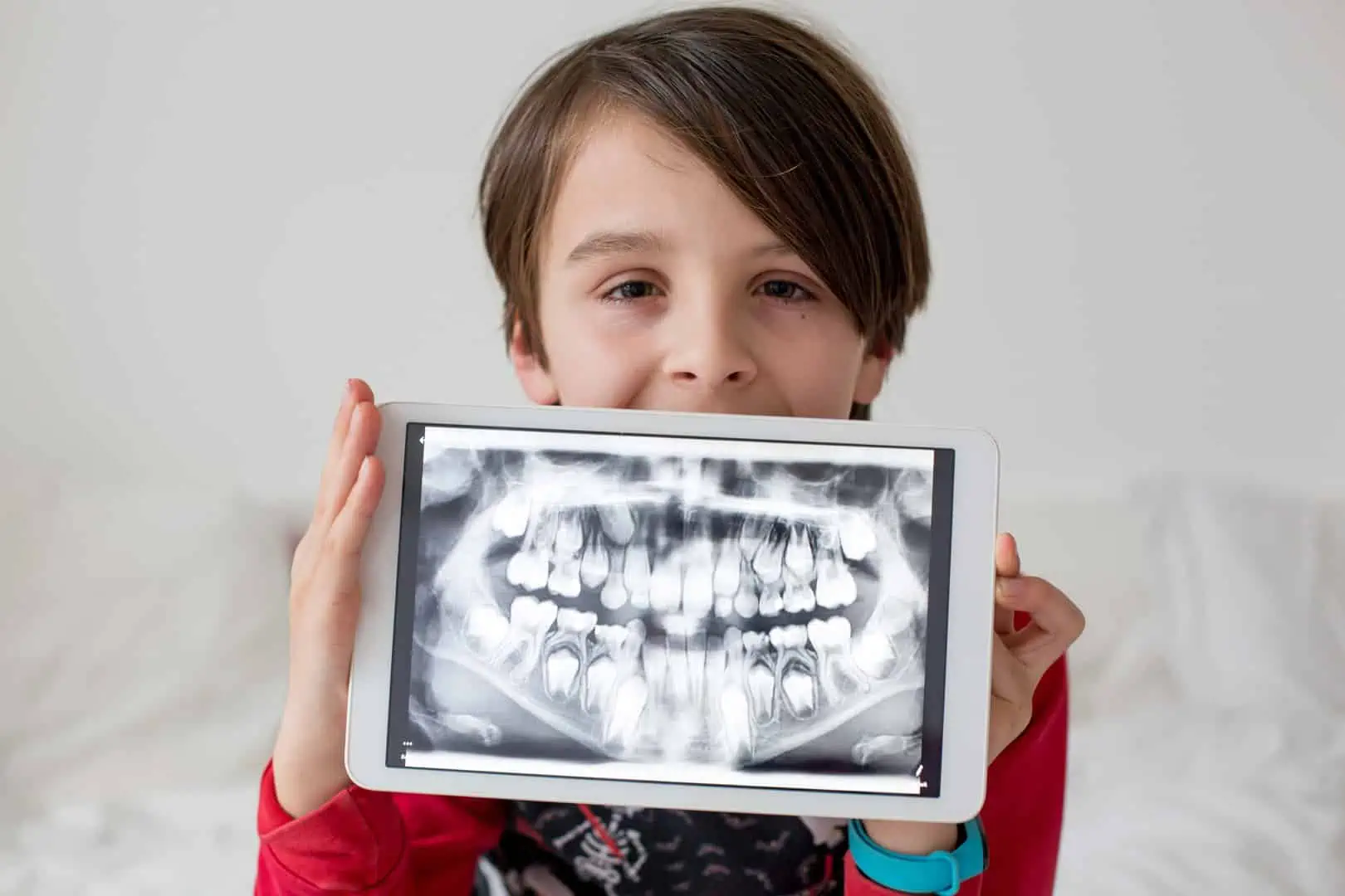 Digital Dental X-Rays
